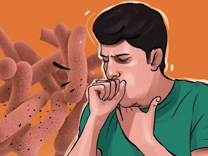 दाङमा क्षयरोगबाट चालु आर्थिक वर्षको ९ महिनाकाे अवधीमा २० जना संक्रमितको मृत्यु