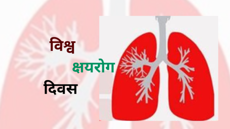 आज विश्व क्षयरोग दिवस मनाइँदै